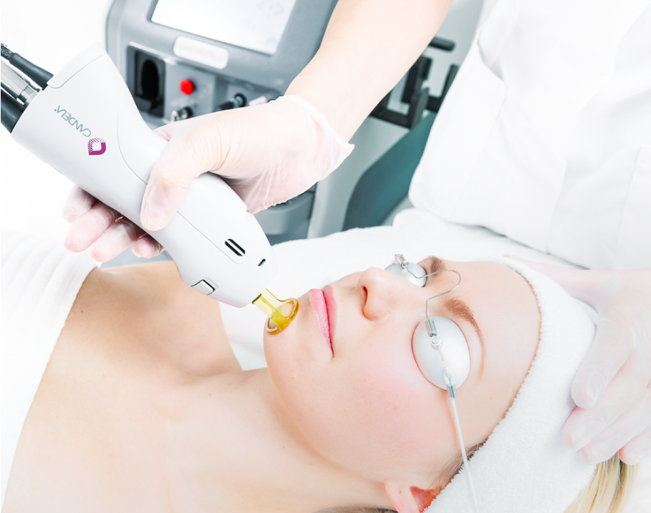 Candela GentleMax Pro Plus medizinisches Dual-Laser-System zur Haarentfernung