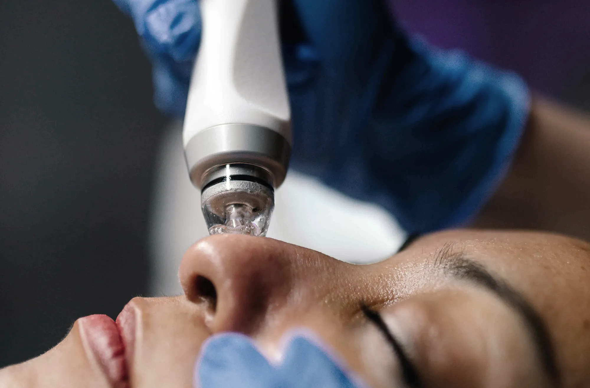 Medizinische Hauterneuerung & Glace Hydrodermabrasion