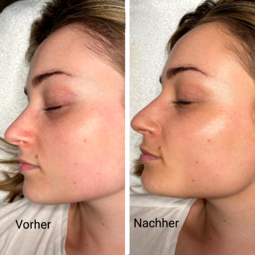 Medizinische Hautqualität und natürlicher Glow Behandlung in Warendorf