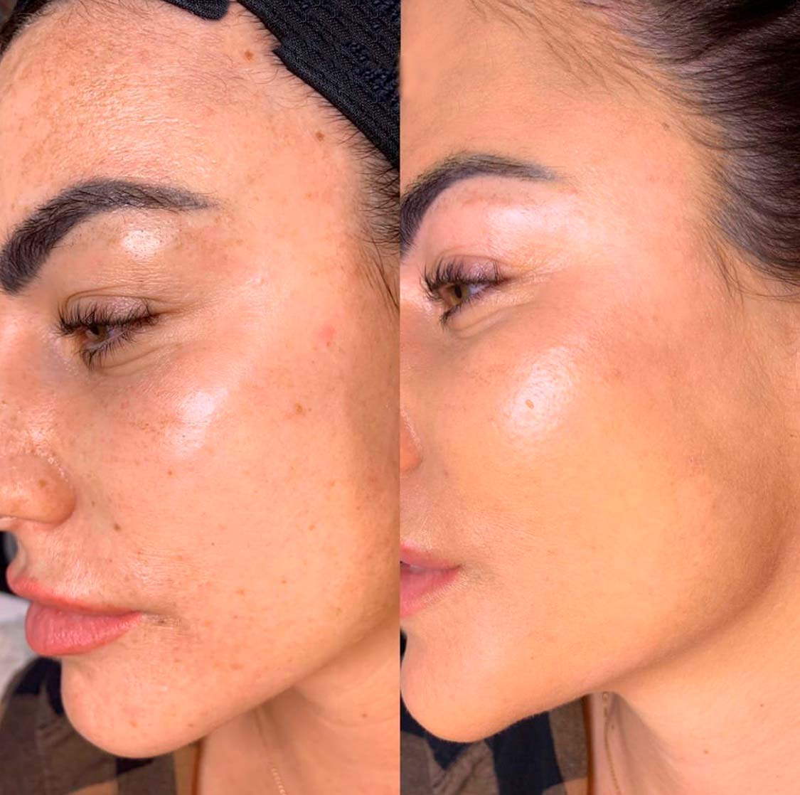 Medizinische Hautqualität und natürlicher Glow Behandlung in Warendorf