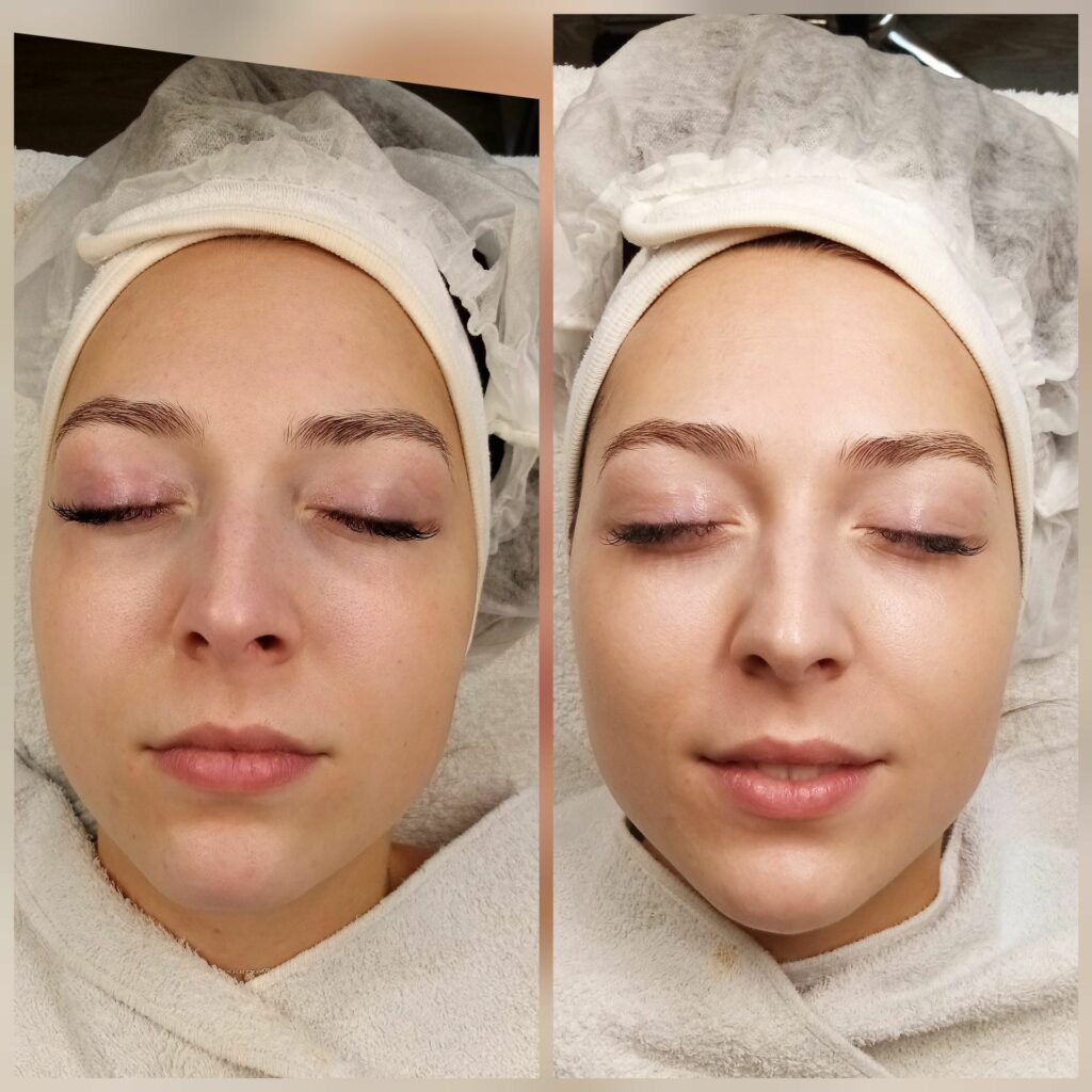 Pigmentbehandlungen mit Pikosekunden-Laser | Fachpraxis Dr. Safar Abilov Warendorf