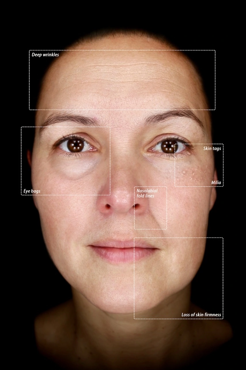 Daylight Mode OBSERV 520x skin analysis Warendorf Münster