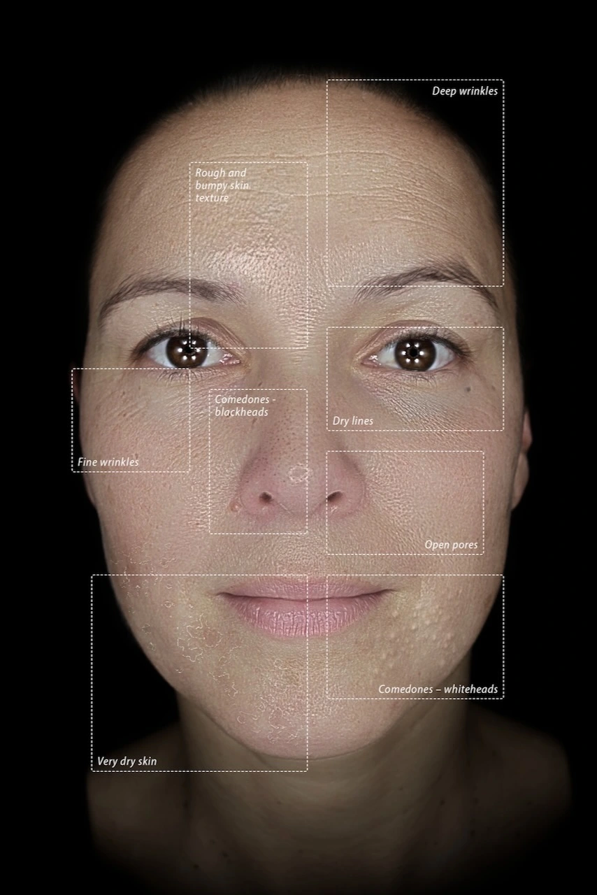 Surface Texture Mode Skin Analysis Münster Warendorf
